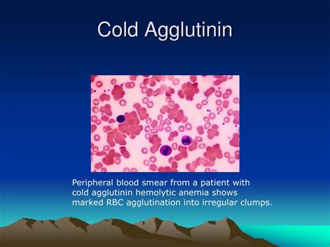 PPT - Anemia PowerPoint Presentation, free download - ID:5934926