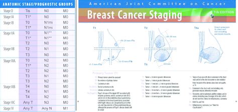 Breast cancer staging on the basis of TNM classification | Download ...