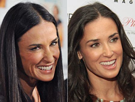 Demi Moore Plastic Surgery Has Changed Her Looks