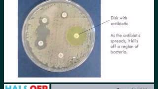 How to Measure Zones of Inhibition