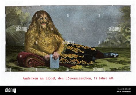 Stephan Bibrowski (18911932), better known as Lionel the Lion-faced ...