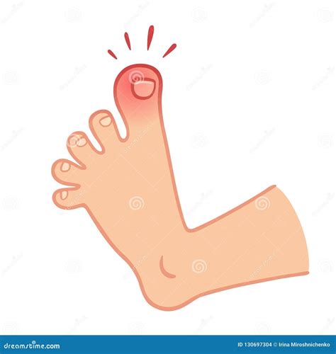 Big Toe Injury Cartoon Vector | CartoonDealer.com #26353589