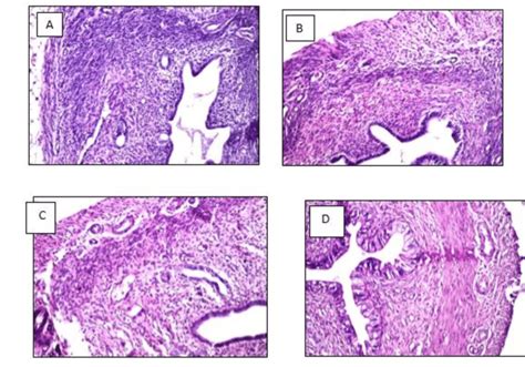 Histological structure of uterus in all different groups [A: Control ...