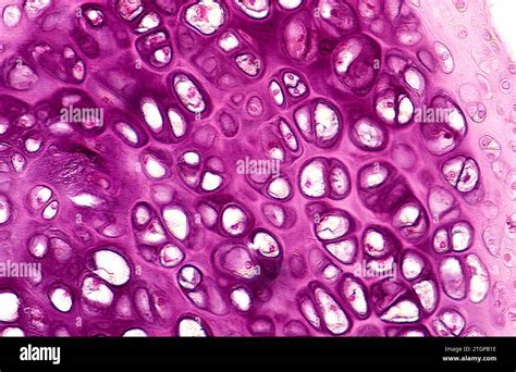 Cartilage section showing chondrocytes, lacunae and matrix. Photomicrograph Stock Photo - Alamy