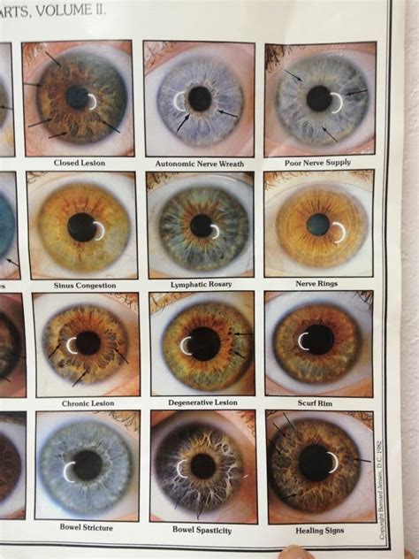 A - Iris Signs Chart #3 | Iridology, Eye color chart, Rare eye colors