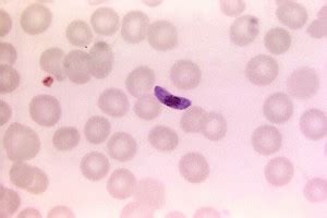 Free picture: babesia, ring, formations, host, erythrocytes