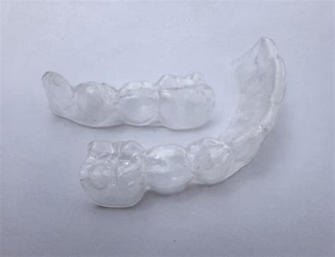 Retainer Replacement: Do You Need It and What's the Cost?