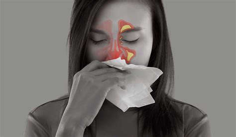 Sinusitis - Acute or chronic is a bummer