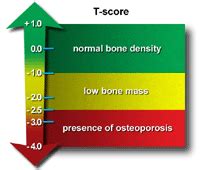 Bone Densitometry | Johns Hopkins Medicine