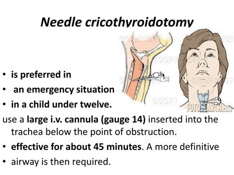 PPT - War Surgery ICRC PowerPoint Presentation, free download - ID:2283136