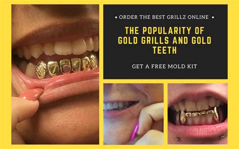 The Popularity Of Gold Grills And Gold Teeth | by Grillzgodzseo | Medium