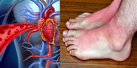 8 Warning Signs Of A Blood Clot That Can't Be Ignored - ArtikuloBlogazine