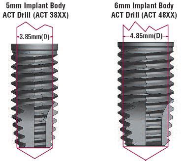 Biomet 3i Dental Implants – Find Local Dentist Near Your Area