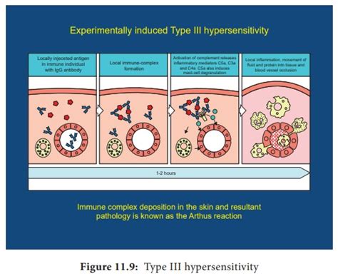 Hypersensitivity - Classification of Hypersensitivity | Immunology