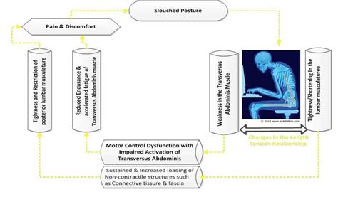 The impact of slouched posture and its associated impairments in... | Download Scientific Diagram