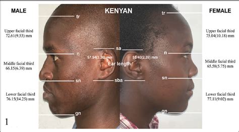 Figure 1 from A Cross-Sectional Study to Determine and Compare the Craniofacial Anthropometric ...