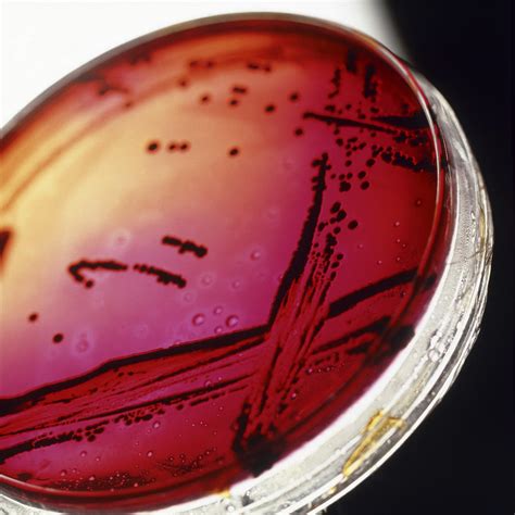 View Of A Petri Dish With Bacterial Cultures Photograph by Tek Image