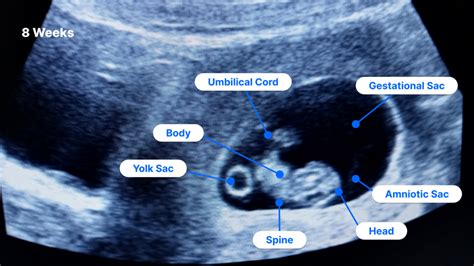 All Pregnancy Ultrasound – swastik