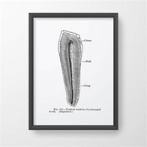 Bicuspid Tooth Structure Dental Oral Surgery Human Anatomy Vintage Art ...