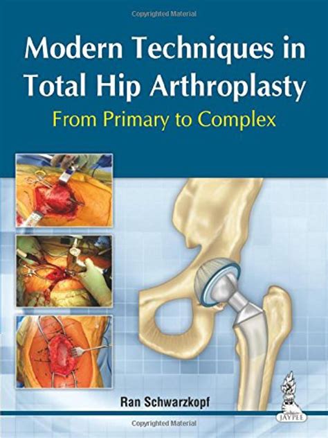 Modern Techniques in Total Hip Arthroplasty ;From Primary to Complex ...