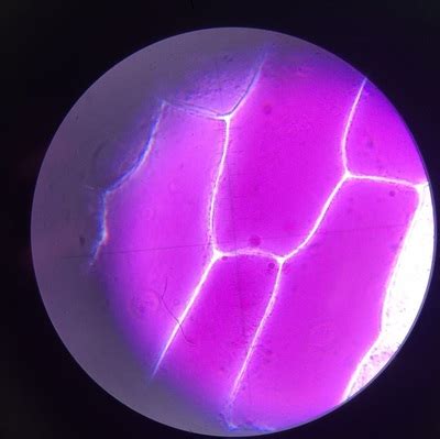 Onion cells plasmolysis - A level biology