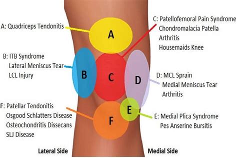 All About Possible Causes And Diagnosis Of Locked Knee - Read News Blog