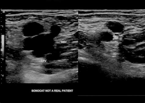 SonoCat - Practical Guide to General Sonography