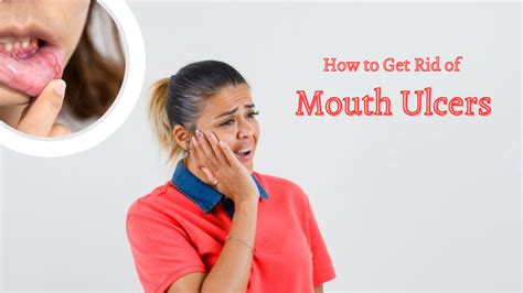 Can Mouth Ulcers Cause Jaw Pain - Infoupdate.org