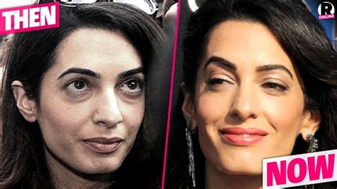 Plastic Is Perfect! Amal Clooney's Shocking New Face Is From Secret Surgery -- See Her ...