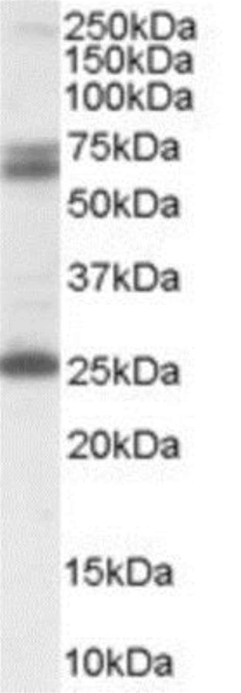 GAD2/GAD65 Antibody 0.1mg; Unlabeled:Antibodies, Polyclonal | Fisher ...