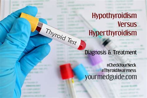 Hypothyroidism Versus Hyperthyroidism, Diagnosis and Treatment - Your ...