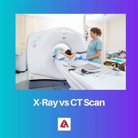 X-Ray vs CT Scan: Difference and Comparison