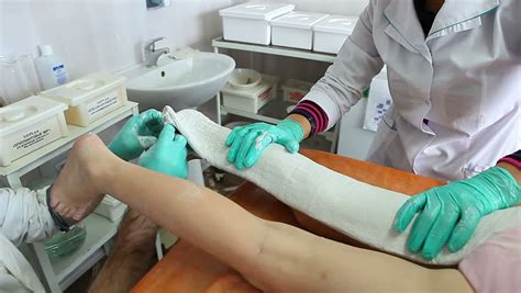 Plaster. Cast A Leg. Stock Footage Video 4371101 - Shutterstock