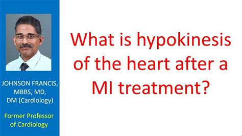 What is hypokinesis of the heart after MI treatment? - YouTube