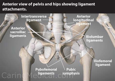 Iliolumbar ligament injury; Iliolumbar Syndrome; Iliac crest pain syndrome – Caring Medical ...