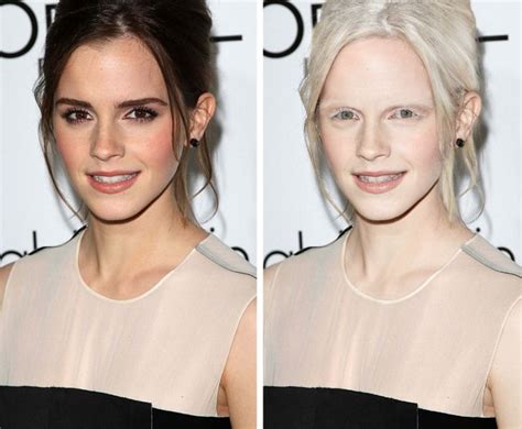 What 15 Celebs Would Look Like If They Were Albinos