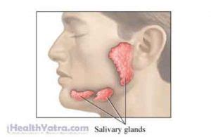 Parotitis Definition, Causes, Symptoms, Complications and Treatment in ...