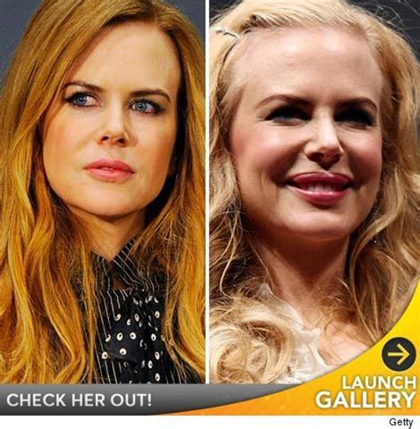 BEAUTY: Nicole Kidman Admits "I Tried Botox!"