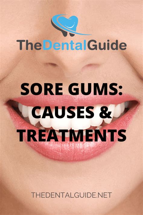 Sore Gums: Causes & Treatments - The Dental Guide