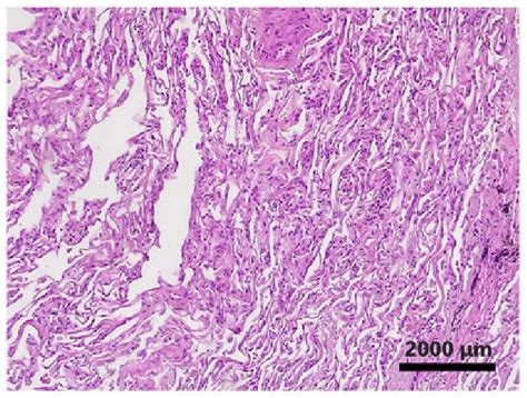 Hematoxylin and eosin staining; original magnification, x100.... | Download Scientific Diagram