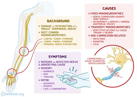 Mononeuropathy: What Is It, Causes, Treatment, and More | Osmosis