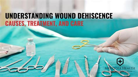 Understanding Wound Dehiscence - Mendota Health