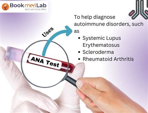 ANA Test: Purpose, Price, Procedure & Results [2025] • Bookmerilab