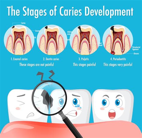 Front Tooth Cavity: From Causes to Cure, Your Complete Guide