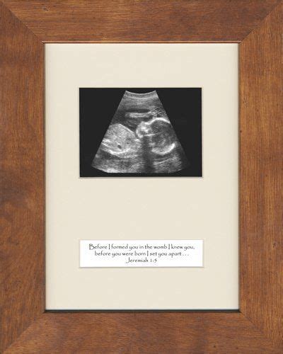 Amazon.com: Sonogram Baby Ultrasound Picture Frame Shower Gift ...