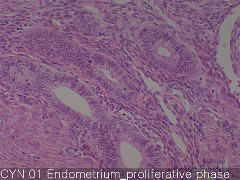 Normal endometrium | Xelonet