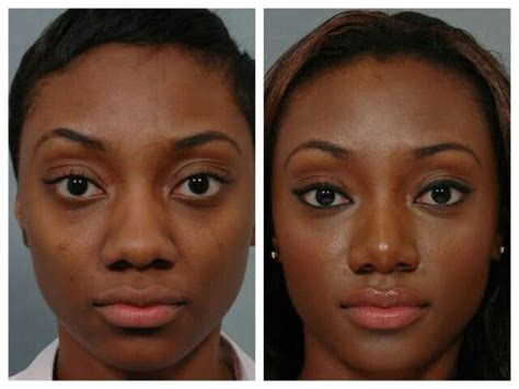 Nose Contouring Before And After