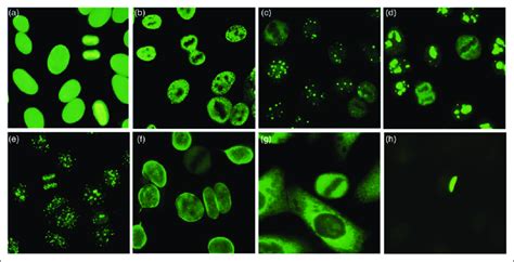 ANA immunofluorescence patterns recognized by the EUROPattern Suite ...