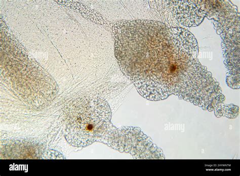 Microscope image of stinging appendages on juvenile jellyfish, UK Stock ...