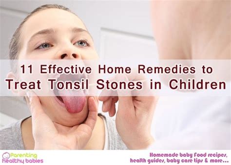 If your baby has tonsil stones, then you can easily treat it at home. There are many home ...